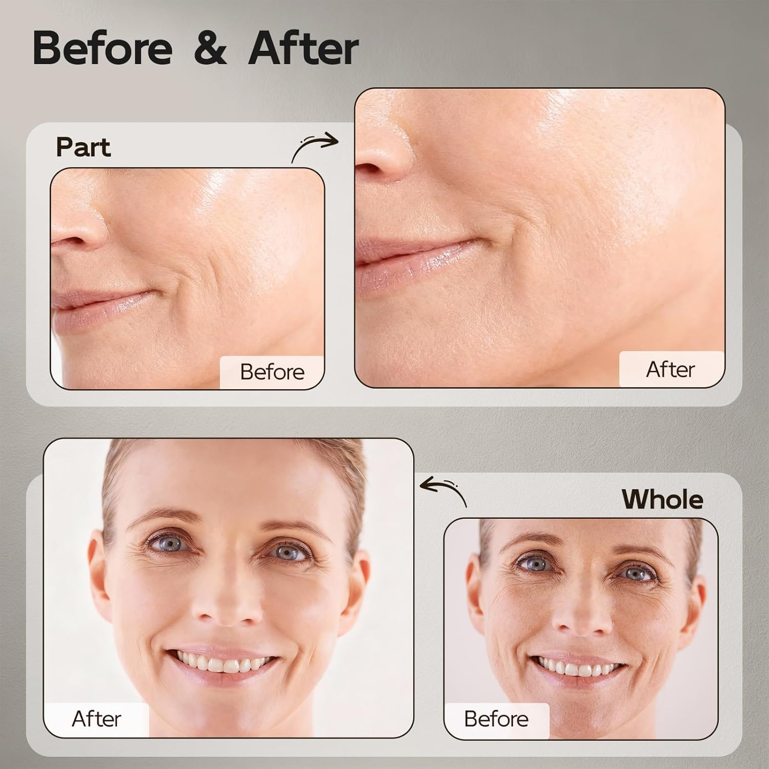 Retinol Serum for Face, Anti Aging & Anti Wrinkle B5 Resurfacing Retinol Serum with Niacinamide, Collagen & Hyaluronic Acid, Smooths Wrinkles & Fine Lines, Dark Spot Corrector, Brighten Dullness