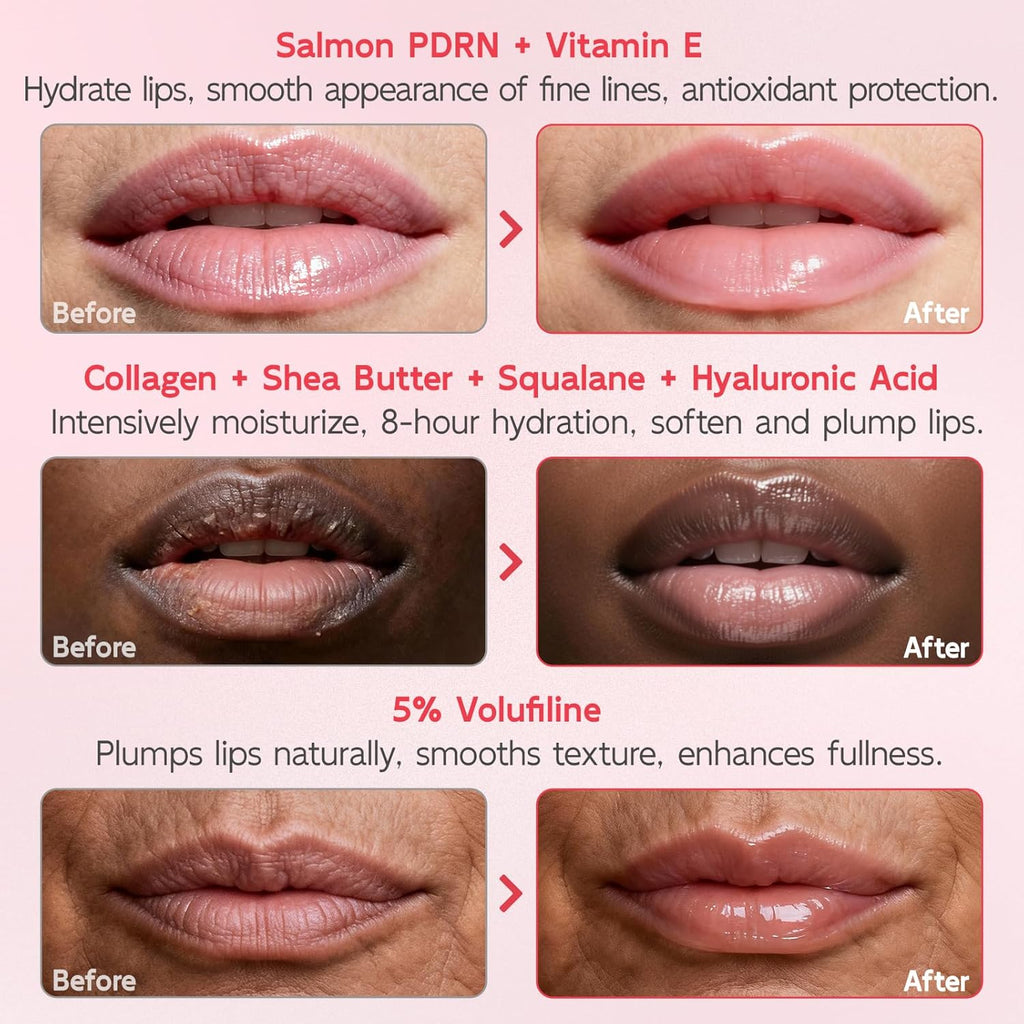 YouthVibe Lip Sleeping Mask Overnight Moisturizing - 5% Volufiline, Squalane, Shea Butter, PDRN & Collagen Hydrating Lip Mask for Dry, Flaky Lips